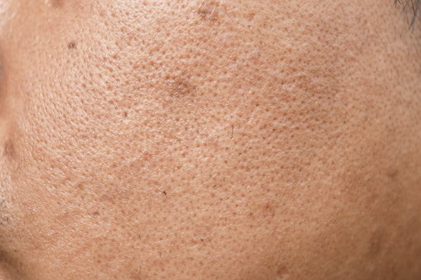 3 things you need to know about banishing pores