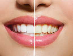 Lipsticks that make your teeth whiter!